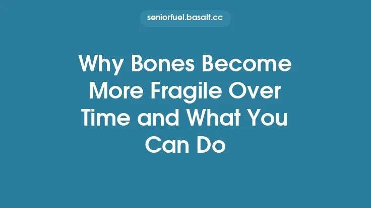 Why Bones Become More Fragile Over Time and What You Can Do Thumbnail